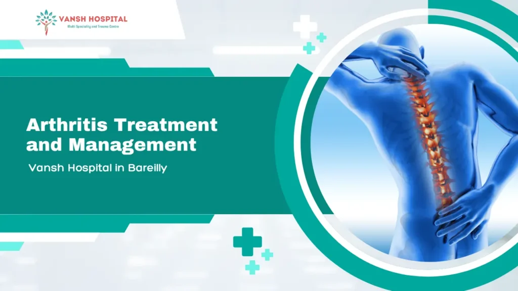 Arthritis treatment in Bareilly